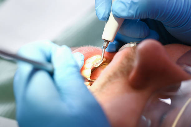 Best Root Canal Emergency Dentist  in Kingwood, WV
