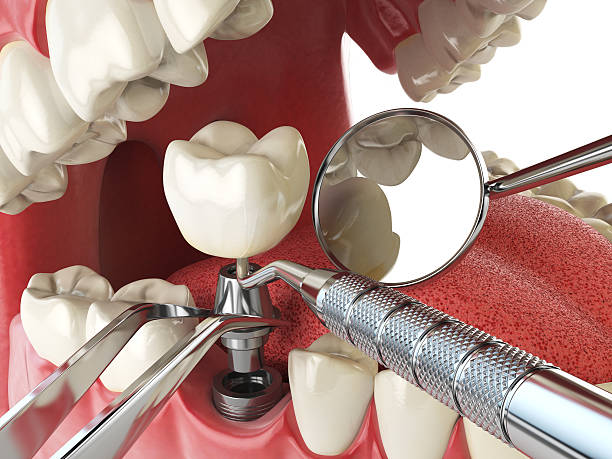 Best Knocked-Out Tooth Emergency  in Kingwood, WV